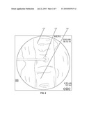 COMPOSITIONS AND METHODS FOR TREATING THE VERTEBRAL COLUMN diagram and image