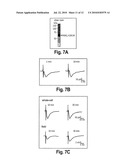 MEMORY ENHANCING PROTEIN diagram and image