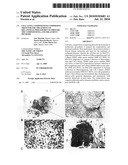 CELL LINES, COMPOSITIONS COMPRISING THEM FOR THE TREATMENT OF MELANOMAS, PROCEDURES TO PREPARE THE COMPOSITIONS, AND TREATMENT METHODS diagram and image