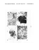 CELL LINES, COMPOSITIONS COMPRISING THEM FOR THE TREATMENT OF MELANOMAS, PROCEDURES TO PREPARE THE COMPOSITIONS, AND TREATMENT METHODS diagram and image