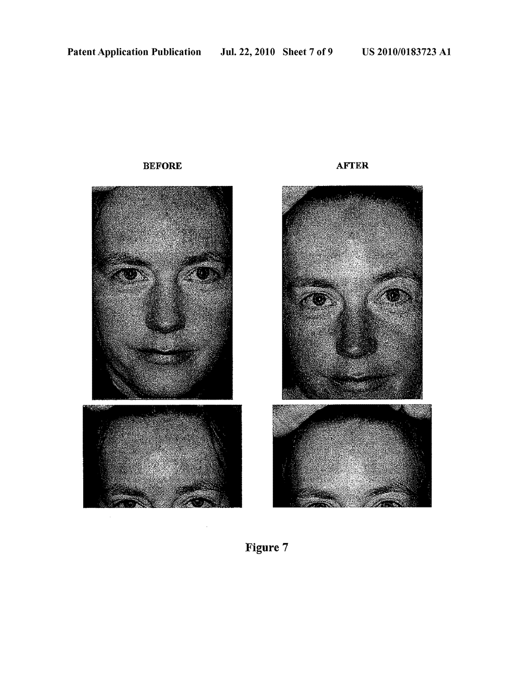 Fetal Skin Cell Protein Compositions for the Treatment of Skin Conditions, Disorders or Diseases and Methods of Making and Using the Same - diagram, schematic, and image 08