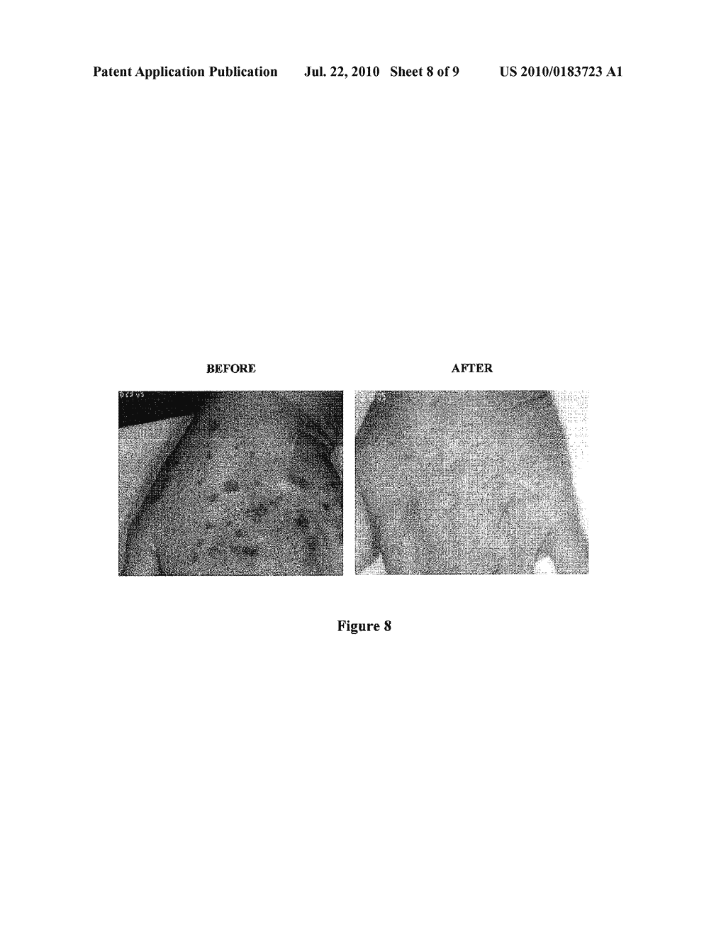 Fetal Skin Cell Protein Compositions for the Treatment of Skin Conditions, Disorders or Diseases and Methods of Making and Using the Same - diagram, schematic, and image 09