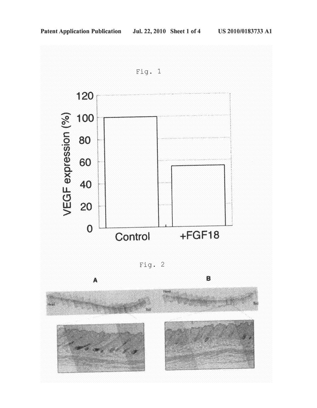 HAIR GROWTH-INHIBITING AGENT - diagram, schematic, and image 02