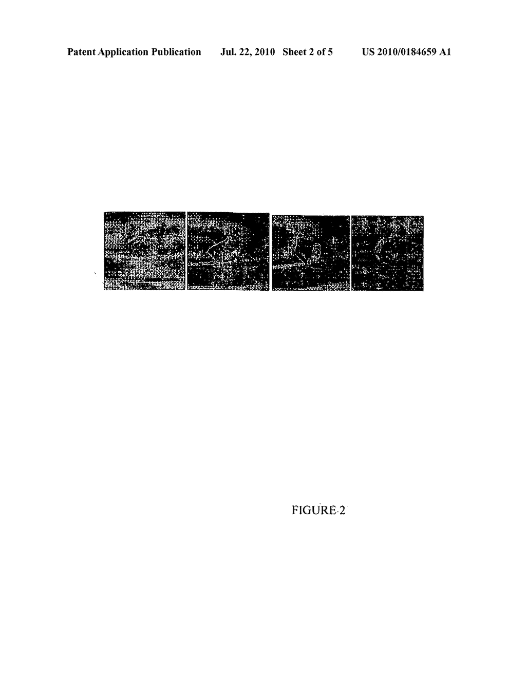 Sustained-Release Formulations Comprising Crystals, Macromolecular Gels, and Particulate Suspensions of Biologic Agents - diagram, schematic, and image 03