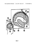 Devices, Systems and Methods for Improving Memory and/or Cognitive Function Through Brain Delivery of Sirna diagram and image