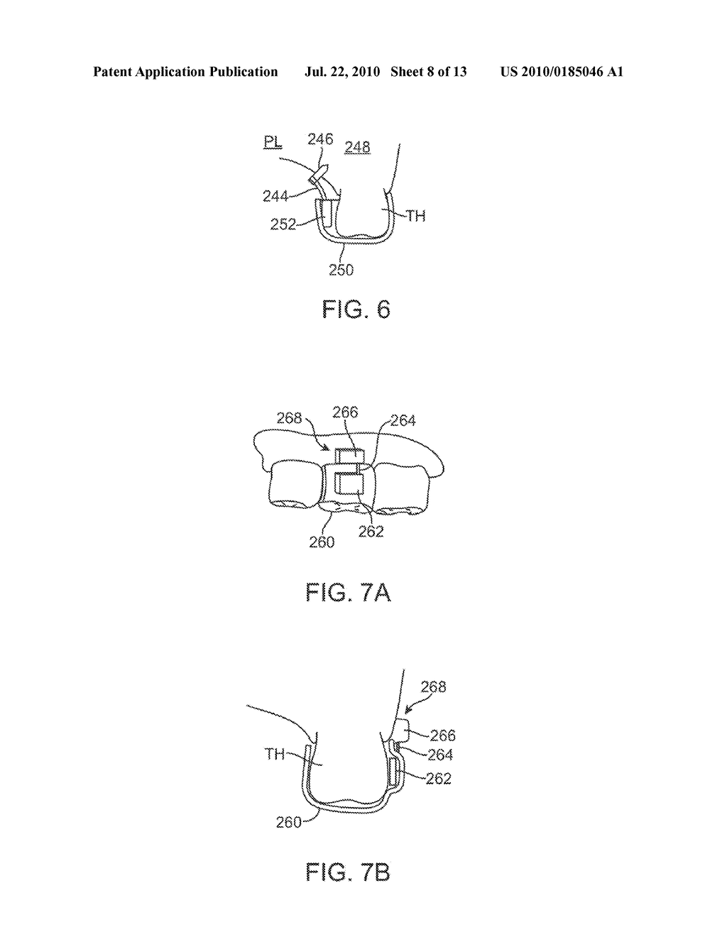 METHODS AND APPARATUS FOR TRANSMITTING VIBRATIONS - diagram, schematic, and image 09