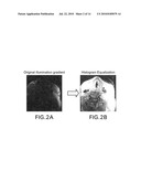 AUTOMATED METHODS AND SYSTEMS FOR VASCULAR PLAQUE DETECTION AND ANALYSIS diagram and image