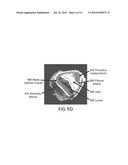 AUTOMATED METHODS AND SYSTEMS FOR VASCULAR PLAQUE DETECTION AND ANALYSIS diagram and image