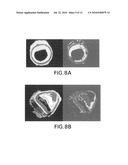 AUTOMATED METHODS AND SYSTEMS FOR VASCULAR PLAQUE DETECTION AND ANALYSIS diagram and image