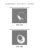 AUTOMATED METHODS AND SYSTEMS FOR VASCULAR PLAQUE DETECTION AND ANALYSIS diagram and image