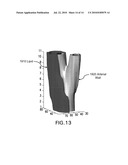 AUTOMATED METHODS AND SYSTEMS FOR VASCULAR PLAQUE DETECTION AND ANALYSIS diagram and image