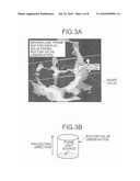 ULTRASOUND DIAGNOSIS APPARATUS, ULTRASOUND IMAGE PROCESSING APPARATUS, IMAGE PROCESSING METHOD, IMAGE DISPLAY METHOD, AND COMPUTER PROGRAM PRODUCT diagram and image