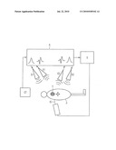 MOVEMENT DETECTION DURING RADIATION TREATMENT USING A RADAR SYSTEM diagram and image