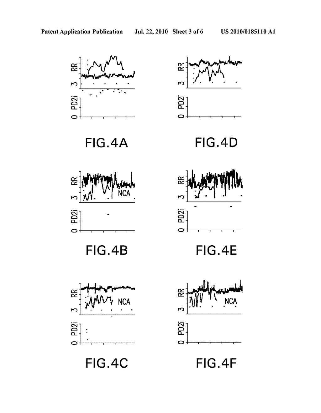 Method and System for Detecting and/or Predicting Biological Anomalies - diagram, schematic, and image 04