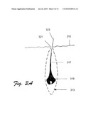 PUNCH BIOPSY DEVICE diagram and image