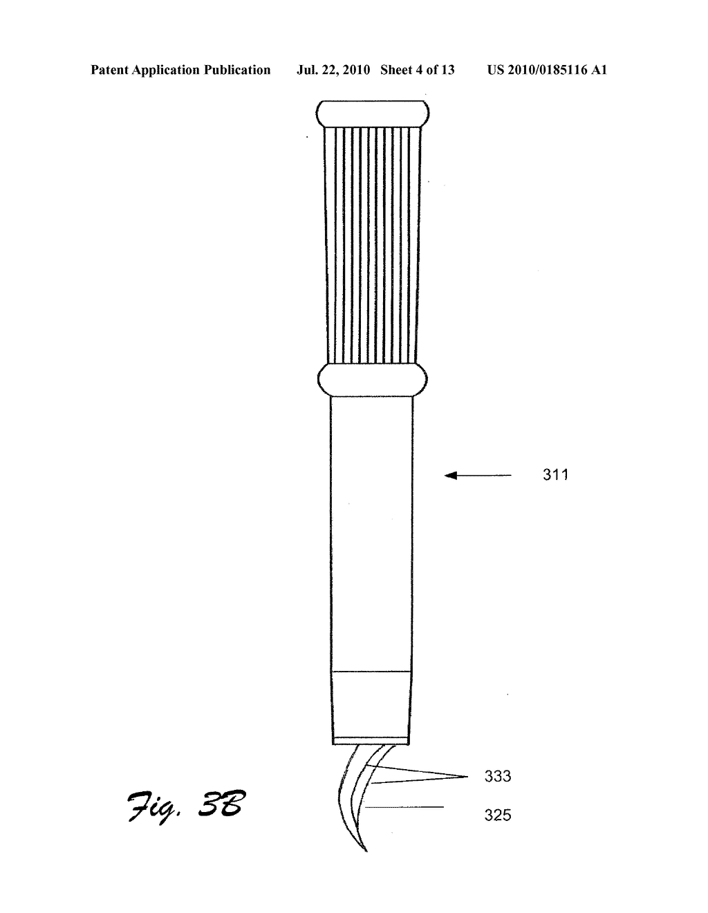 PUNCH BIOPSY DEVICE - diagram, schematic, and image 05