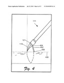 PUNCH BIOPSY DEVICE diagram and image