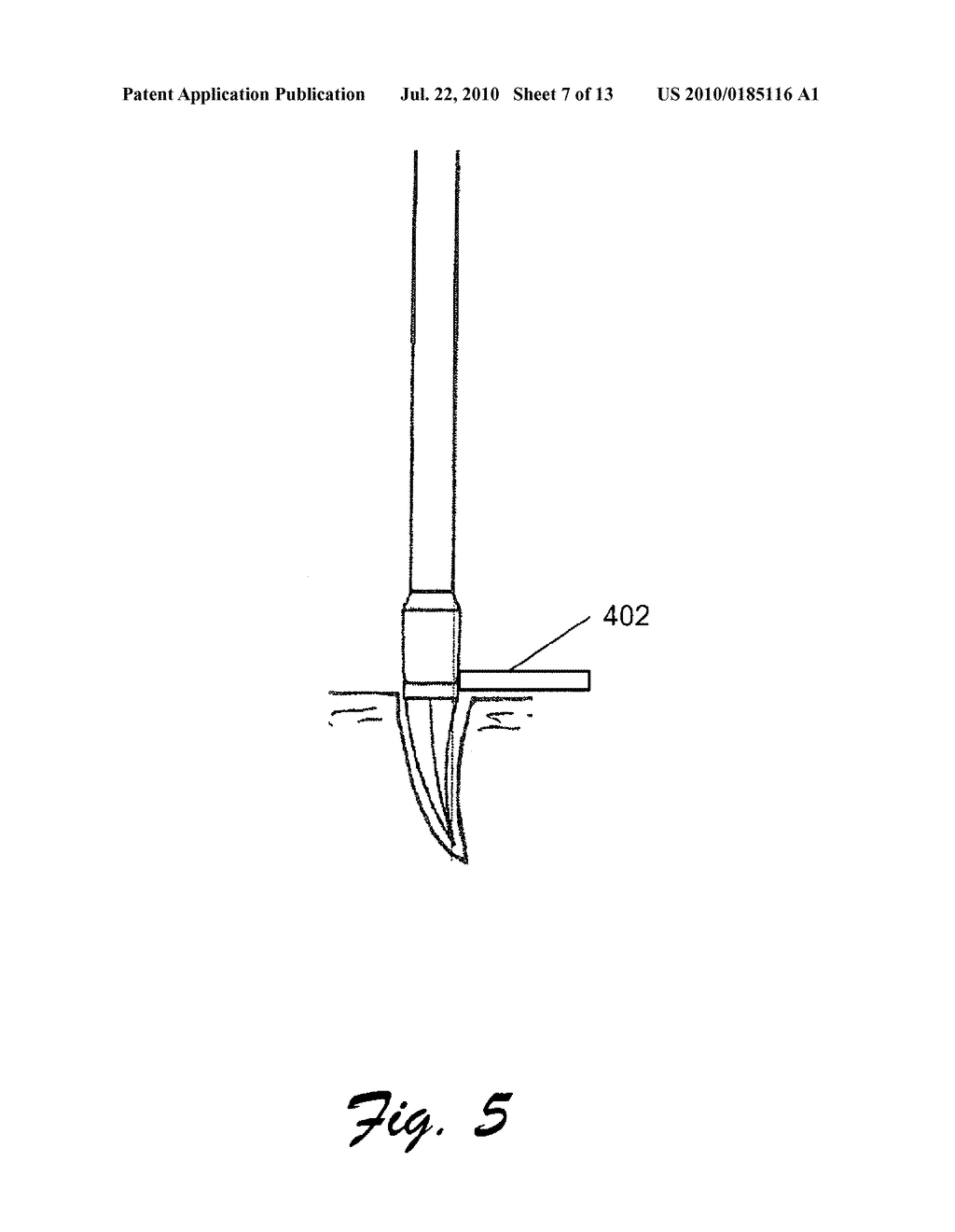 PUNCH BIOPSY DEVICE - diagram, schematic, and image 08