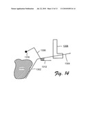 PUNCH BIOPSY DEVICE diagram and image