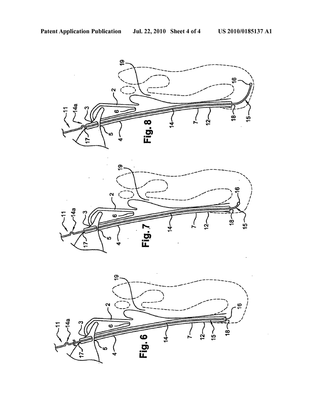 DEVICE FOR TREATMENT OF WATERING OF THE EYE - diagram, schematic, and image 05