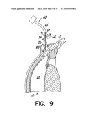 FLOW REGULATING IMPLANT, METHOD OF MANUFACTURE, AND DELIVERY DEVICE diagram and image