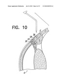 FLOW REGULATING IMPLANT, METHOD OF MANUFACTURE, AND DELIVERY DEVICE diagram and image