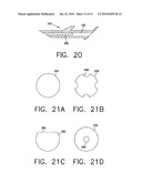 FLOW REGULATING IMPLANT, METHOD OF MANUFACTURE, AND DELIVERY DEVICE diagram and image