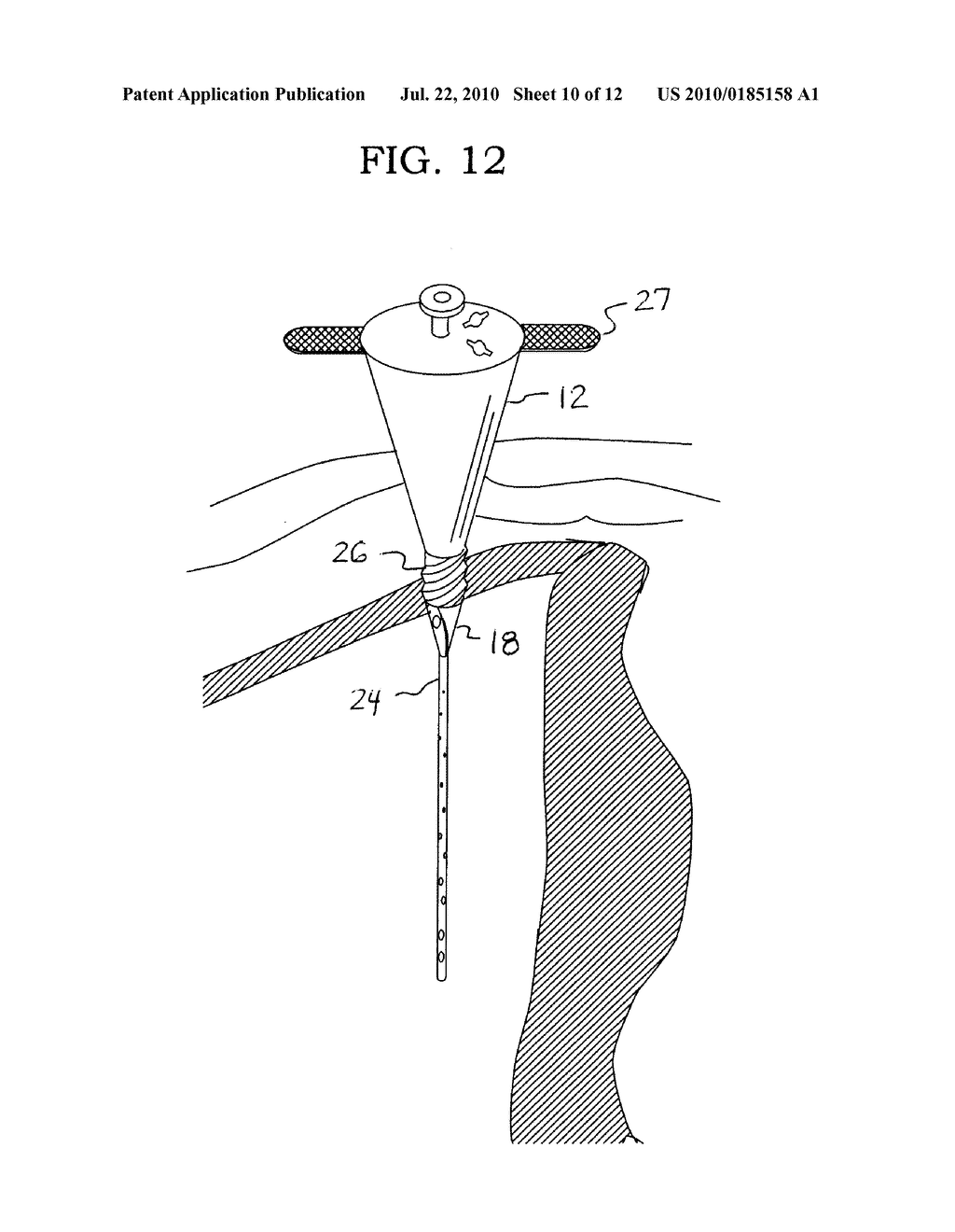 METHOD AND APPARATUS FOR ASPIRATION - diagram, schematic, and image 11