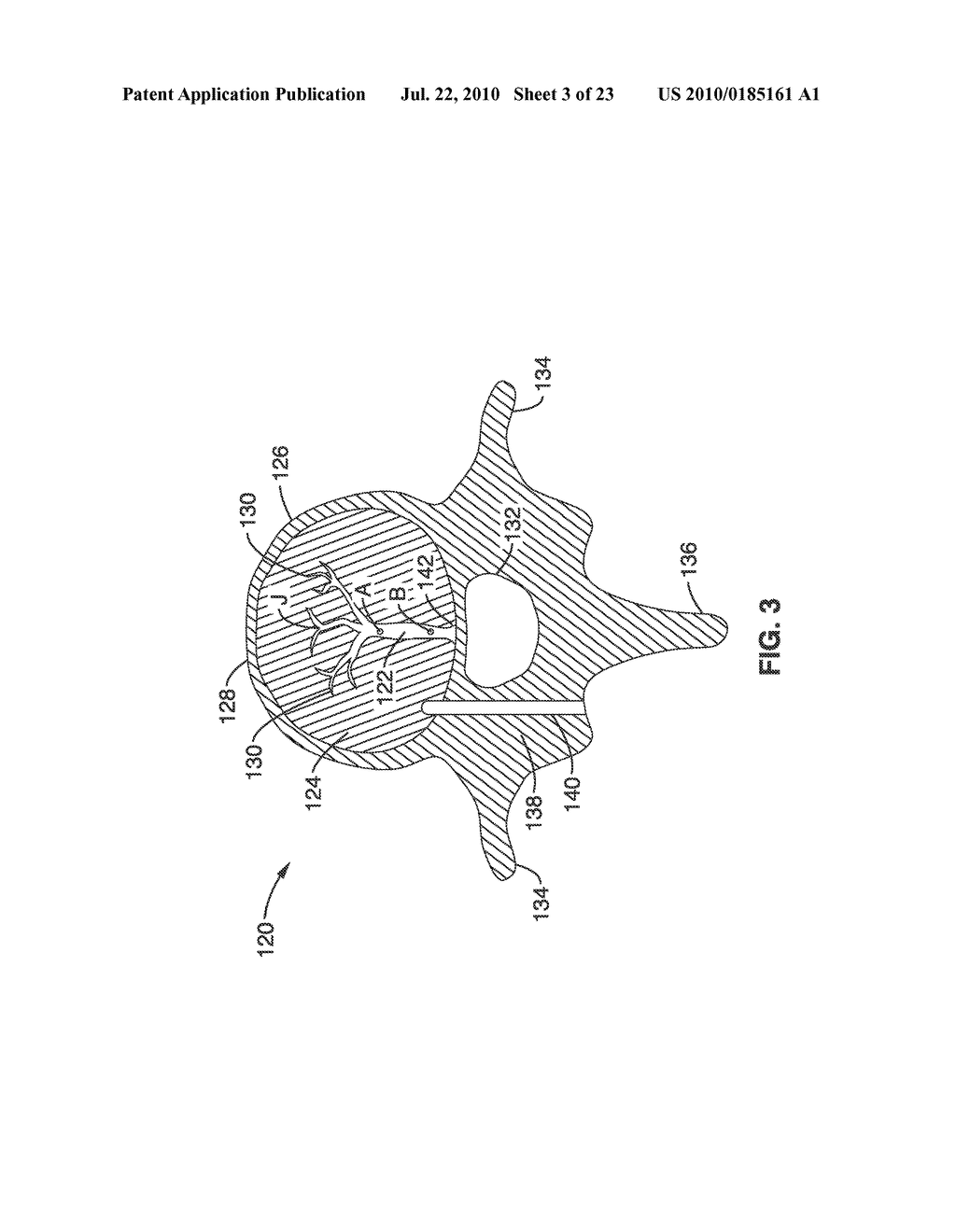 SYSTEMS AND METHODS FOR NAVIGATING AN INSTRUMENT THROUGH BONE - diagram, schematic, and image 04