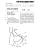 DIAGNOSTIC CATHETERS, GUIDE CATHETERS, VISUALIZATION DEVICES AND CHORD MANIPULATION DEVICES, AND RELATED KITS AND METHODS diagram and image