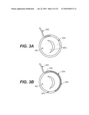 DIAGNOSTIC CATHETERS, GUIDE CATHETERS, VISUALIZATION DEVICES AND CHORD MANIPULATION DEVICES, AND RELATED KITS AND METHODS diagram and image