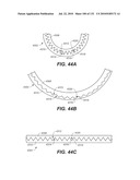 DIAGNOSTIC CATHETERS, GUIDE CATHETERS, VISUALIZATION DEVICES AND CHORD MANIPULATION DEVICES, AND RELATED KITS AND METHODS diagram and image