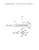 DIAGNOSTIC CATHETERS, GUIDE CATHETERS, VISUALIZATION DEVICES AND CHORD MANIPULATION DEVICES, AND RELATED KITS AND METHODS diagram and image