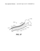 DIAGNOSTIC CATHETERS, GUIDE CATHETERS, VISUALIZATION DEVICES AND CHORD MANIPULATION DEVICES, AND RELATED KITS AND METHODS diagram and image