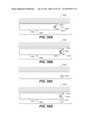 DIAGNOSTIC CATHETERS, GUIDE CATHETERS, VISUALIZATION DEVICES AND CHORD MANIPULATION DEVICES, AND RELATED KITS AND METHODS diagram and image