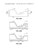 DIAGNOSTIC CATHETERS, GUIDE CATHETERS, VISUALIZATION DEVICES AND CHORD MANIPULATION DEVICES, AND RELATED KITS AND METHODS diagram and image