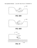 DIAGNOSTIC CATHETERS, GUIDE CATHETERS, VISUALIZATION DEVICES AND CHORD MANIPULATION DEVICES, AND RELATED KITS AND METHODS diagram and image