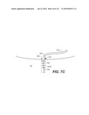 DIAGNOSTIC CATHETERS, GUIDE CATHETERS, VISUALIZATION DEVICES AND CHORD MANIPULATION DEVICES, AND RELATED KITS AND METHODS diagram and image