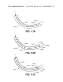 DIAGNOSTIC CATHETERS, GUIDE CATHETERS, VISUALIZATION DEVICES AND CHORD MANIPULATION DEVICES, AND RELATED KITS AND METHODS diagram and image