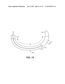 DIAGNOSTIC CATHETERS, GUIDE CATHETERS, VISUALIZATION DEVICES AND CHORD MANIPULATION DEVICES, AND RELATED KITS AND METHODS diagram and image