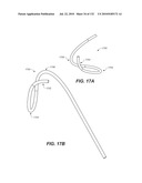 DIAGNOSTIC CATHETERS, GUIDE CATHETERS, VISUALIZATION DEVICES AND CHORD MANIPULATION DEVICES, AND RELATED KITS AND METHODS diagram and image