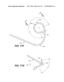 DIAGNOSTIC CATHETERS, GUIDE CATHETERS, VISUALIZATION DEVICES AND CHORD MANIPULATION DEVICES, AND RELATED KITS AND METHODS diagram and image