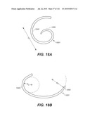 DIAGNOSTIC CATHETERS, GUIDE CATHETERS, VISUALIZATION DEVICES AND CHORD MANIPULATION DEVICES, AND RELATED KITS AND METHODS diagram and image