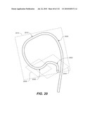 DIAGNOSTIC CATHETERS, GUIDE CATHETERS, VISUALIZATION DEVICES AND CHORD MANIPULATION DEVICES, AND RELATED KITS AND METHODS diagram and image