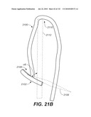 DIAGNOSTIC CATHETERS, GUIDE CATHETERS, VISUALIZATION DEVICES AND CHORD MANIPULATION DEVICES, AND RELATED KITS AND METHODS diagram and image