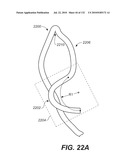 DIAGNOSTIC CATHETERS, GUIDE CATHETERS, VISUALIZATION DEVICES AND CHORD MANIPULATION DEVICES, AND RELATED KITS AND METHODS diagram and image