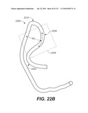 DIAGNOSTIC CATHETERS, GUIDE CATHETERS, VISUALIZATION DEVICES AND CHORD MANIPULATION DEVICES, AND RELATED KITS AND METHODS diagram and image