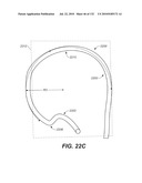 DIAGNOSTIC CATHETERS, GUIDE CATHETERS, VISUALIZATION DEVICES AND CHORD MANIPULATION DEVICES, AND RELATED KITS AND METHODS diagram and image