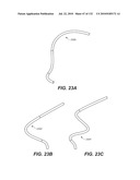 DIAGNOSTIC CATHETERS, GUIDE CATHETERS, VISUALIZATION DEVICES AND CHORD MANIPULATION DEVICES, AND RELATED KITS AND METHODS diagram and image