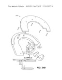 DIAGNOSTIC CATHETERS, GUIDE CATHETERS, VISUALIZATION DEVICES AND CHORD MANIPULATION DEVICES, AND RELATED KITS AND METHODS diagram and image